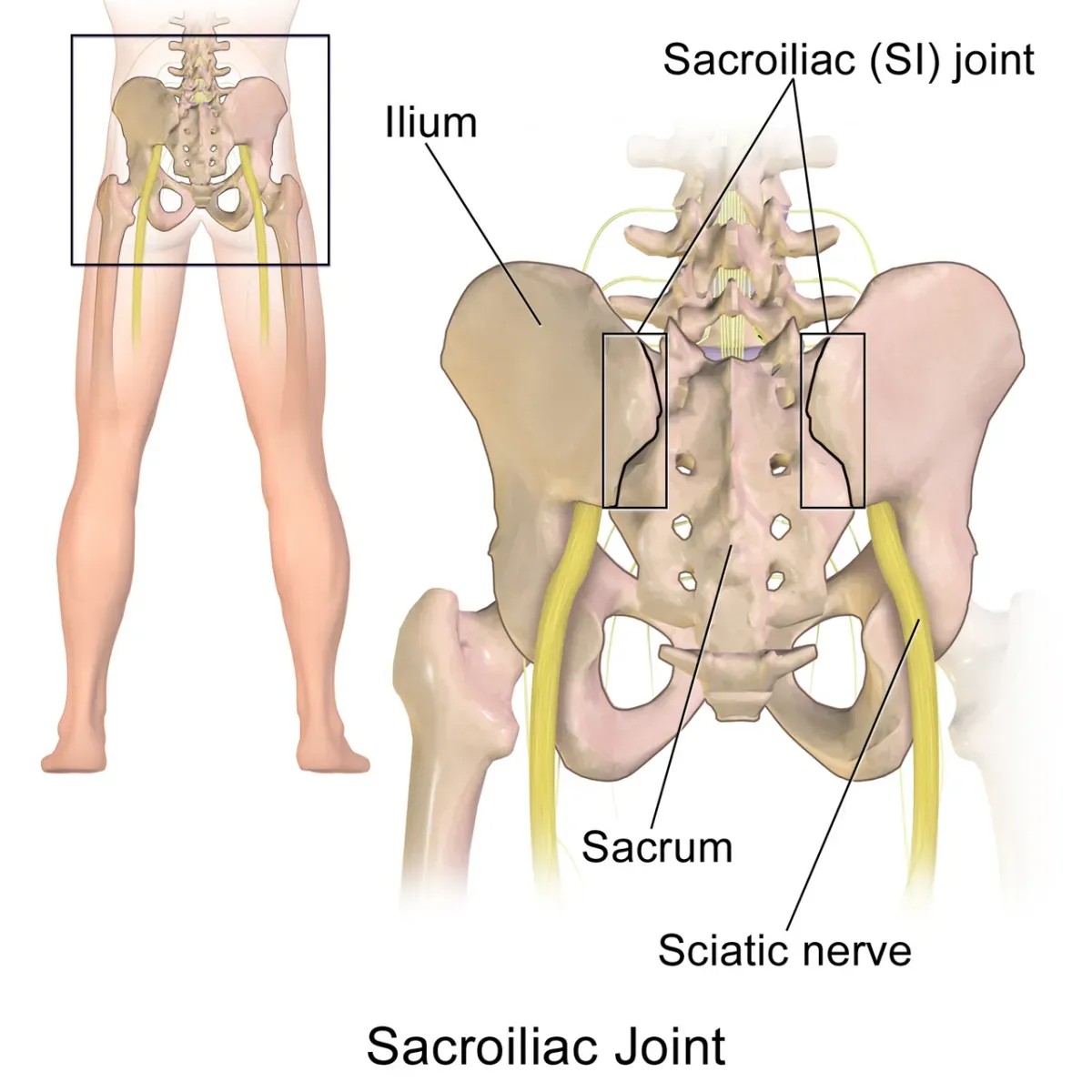 Anatomical diagram of the pelvis from behind labelling the sacroiliac joint, sacrum, ilium and sciatic nerve